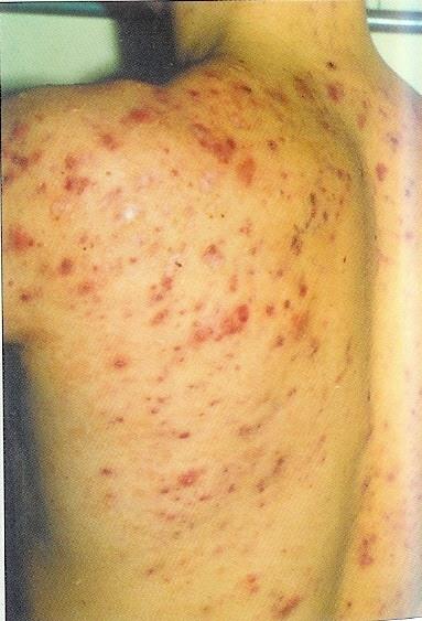 b12